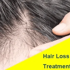 2-HAIR-LOSS_jpg_webp