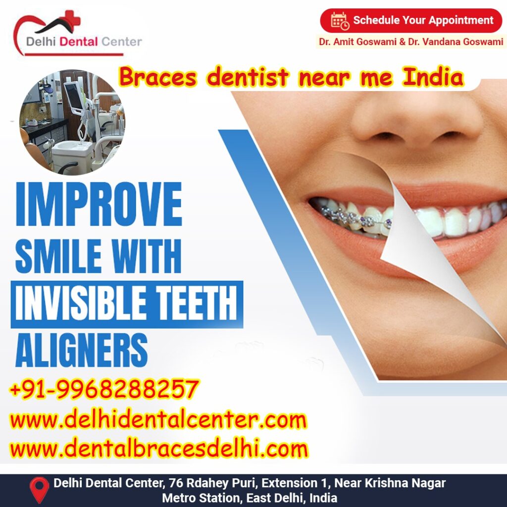 Best top Painless Adult Invisible Dental Braces Aligners Treatment, Price of Dental Braces treatment in India