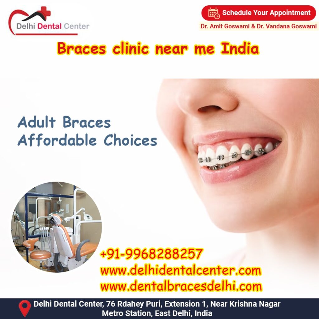 Best top Painless Adult Invisible Dental Braces Aligners Treatment, Dental Braces Cost in India