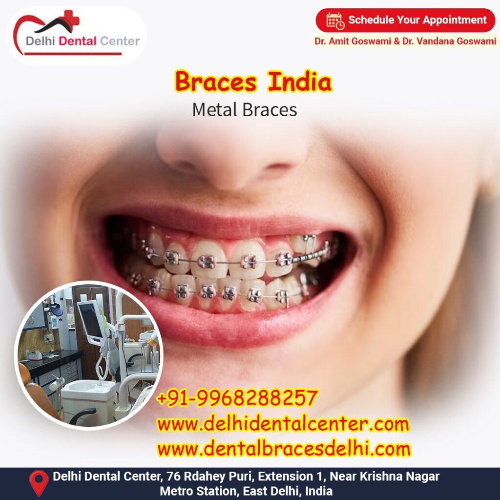 Best top Painless Adult Invisible Dental Braces Aligners Treatment, Orthodontic Treatment in India