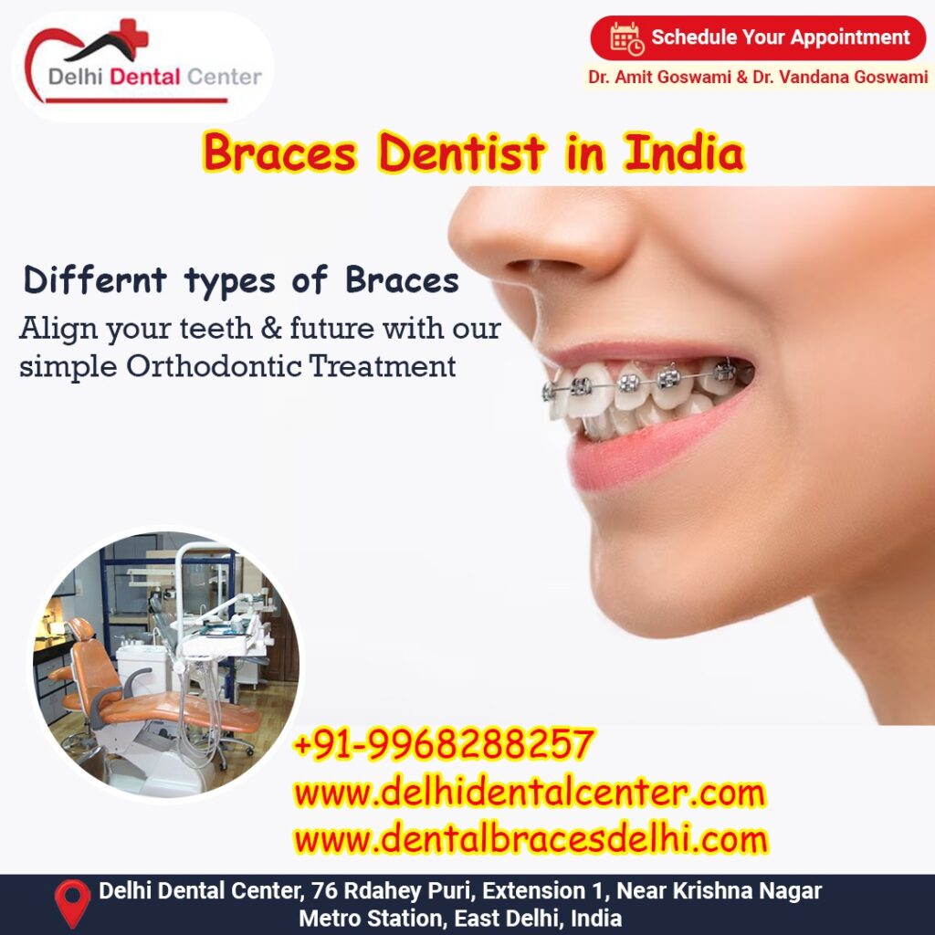 Best top Painless Adult Invisible Dental Braces Aligners Treatment, Dental Braces India