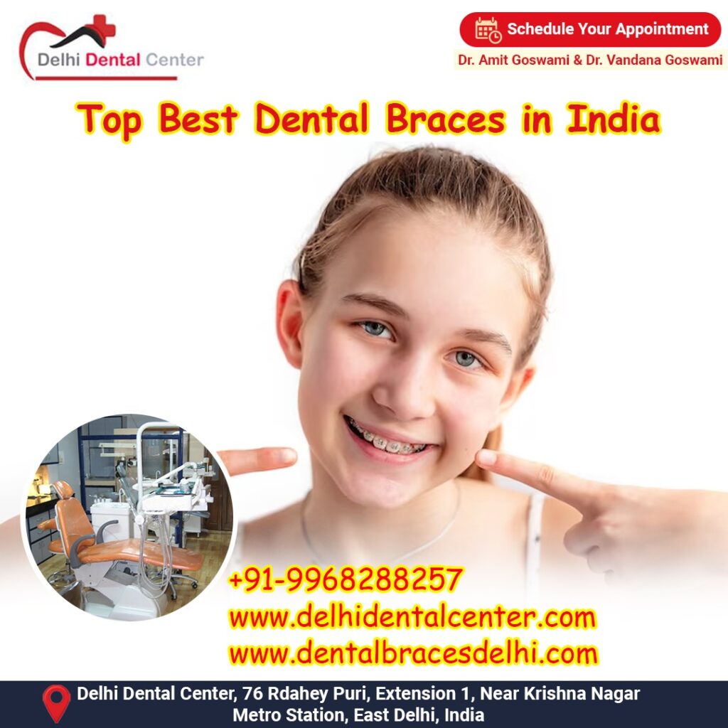 Best top Painless Adult Invisible Dental Braces Aligners Treatment, Braces Specialist Dentist in India
