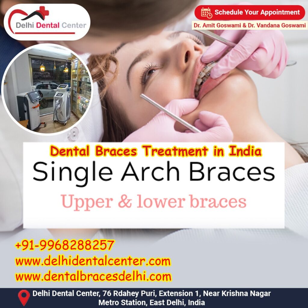 Best top Painless Adult Invisible Dental Braces Aligners Treatment, Top Best Dental Braces in India
