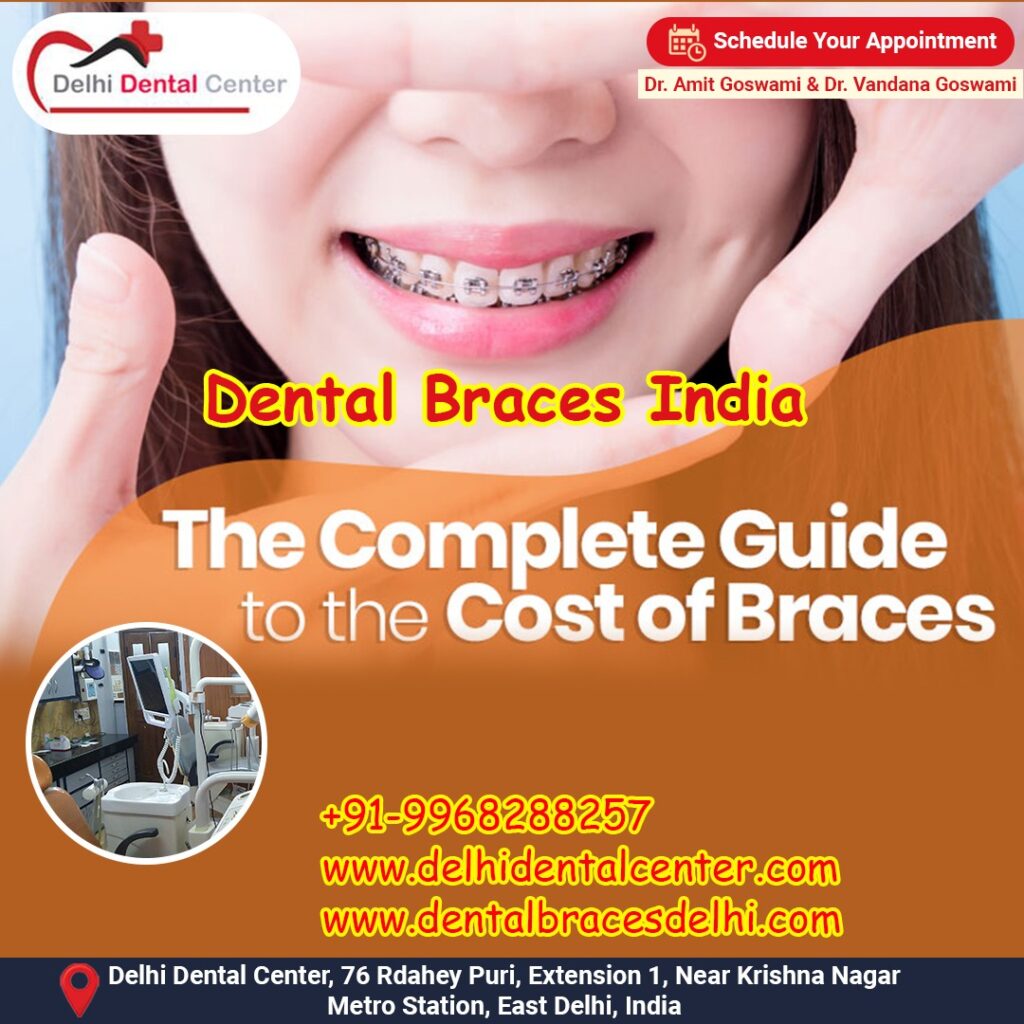 Best top Painless Adult Invisible Dental Braces Aligners Treatment, Dental Braces Treatment in India