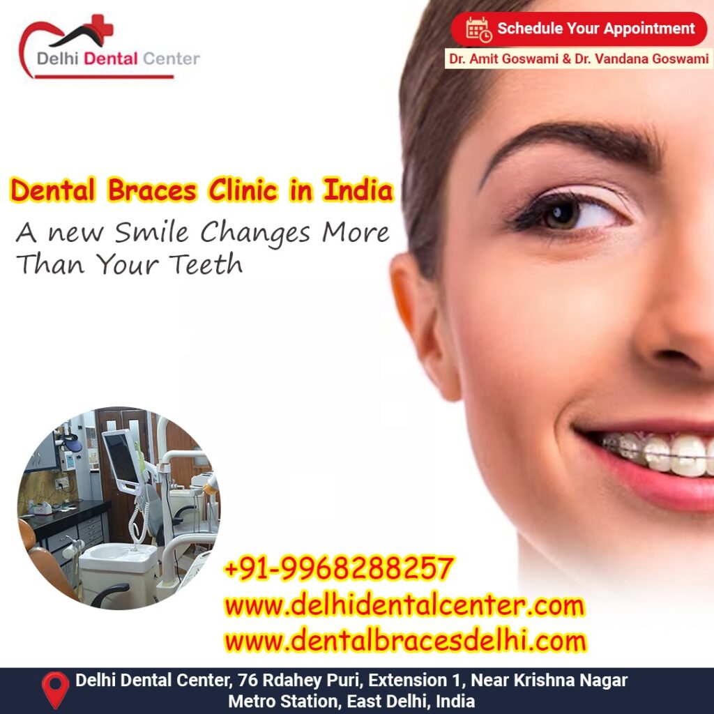 Best top Painless Adult Invisible Dental Braces Aligners Treatment, Dental Braces Treatment in India