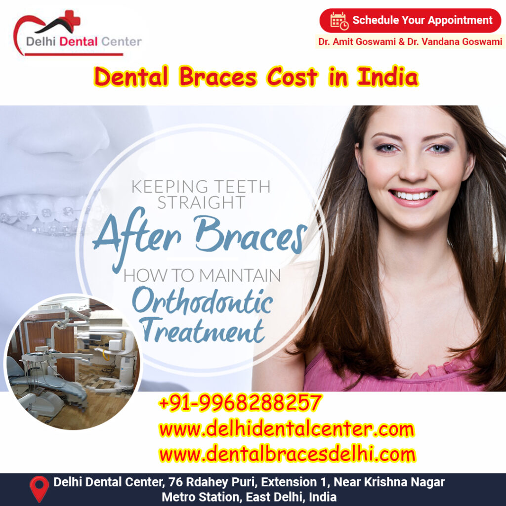Best top Painless Adult Invisible Dental Braces Aligners Treatment, Orthodontist India