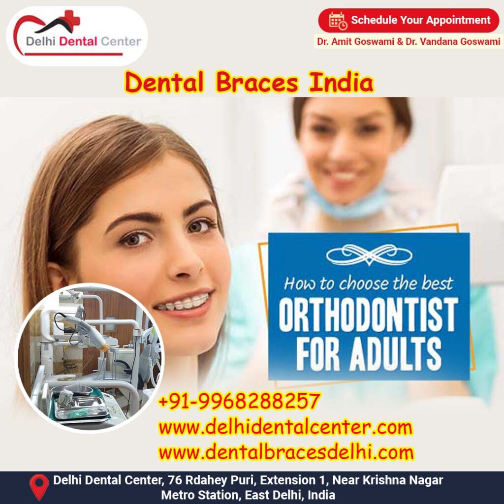 Best top Painless Adult Invisible Dental Braces Aligners Treatment, Dental Braces Clinic in India