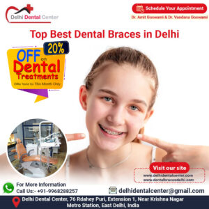 Top Best Dental Braces in Delhi