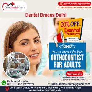 Dental Braces Delhi