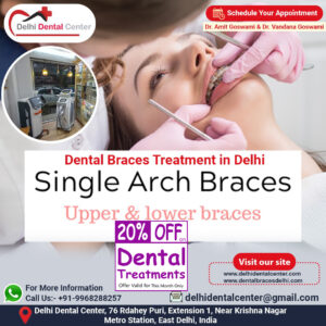 Dental Braces Treatment in Delhi