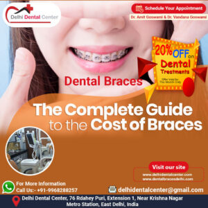 Dental Braces