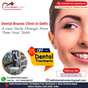 Dental Braces Clinic in Delhi