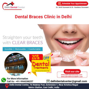 Dental Braces Delhi Clinic